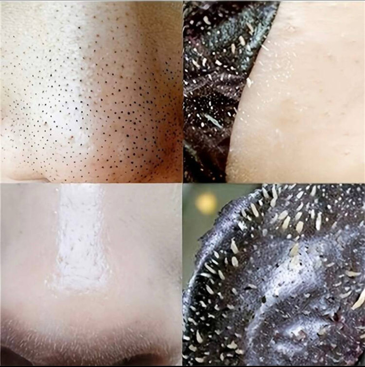 Nose strips