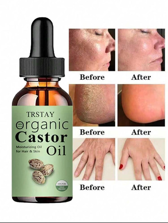روغن کاستور(کرچک هیدروژنه) غیر خوراکی از برند Trstay