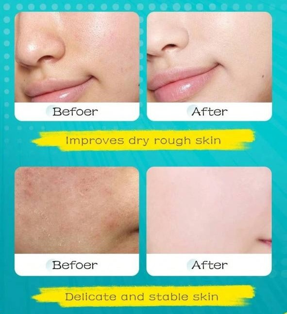 Facial Mask