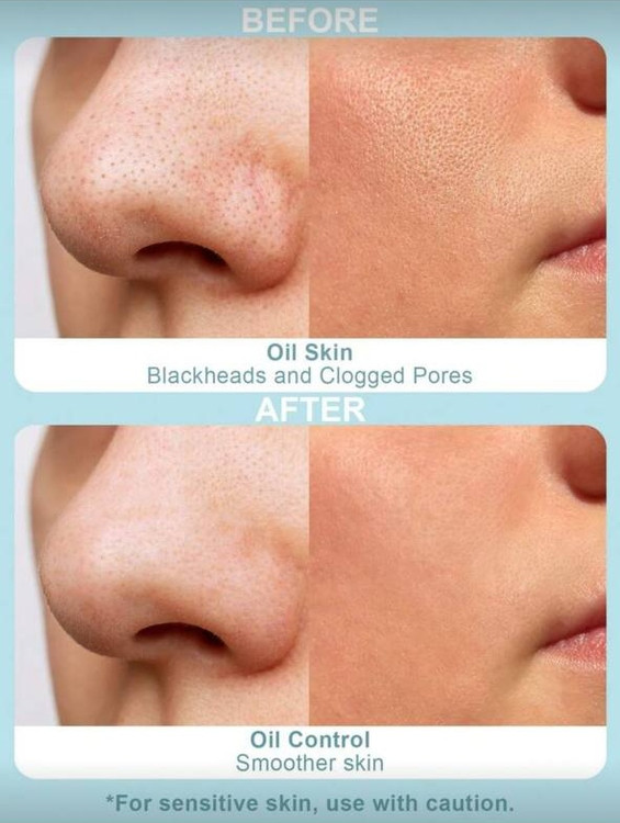 Slow 8 Day Deep Cleansing Mask – Charcoal Bubbling