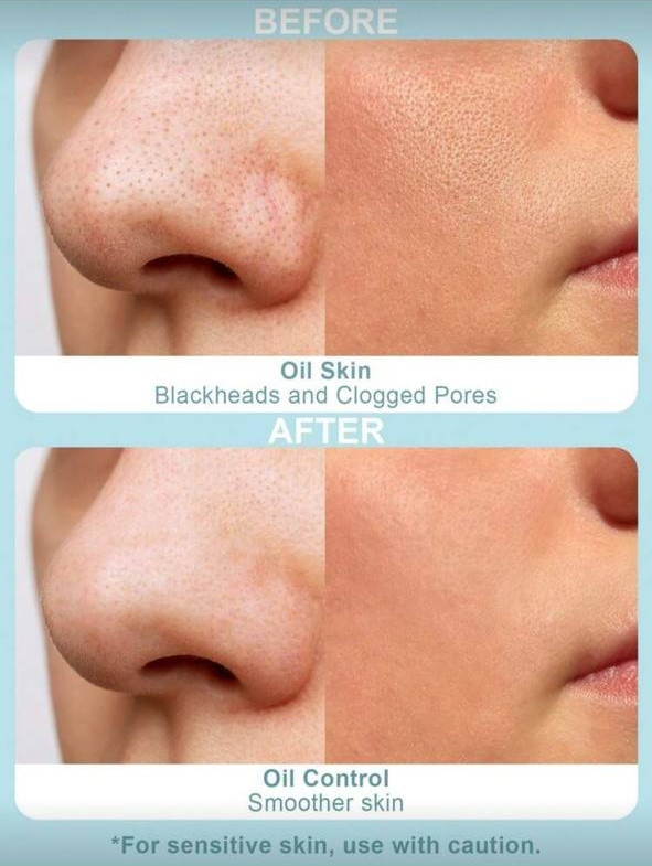 Slow 8 Day Deep Cleansing Mask – Charcoal Bubbling